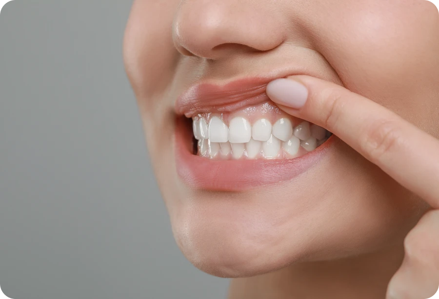 gencives saines alti dent Enseignement à l’hygiène bucco-dentaire Cabinet dentaire Alti Dent