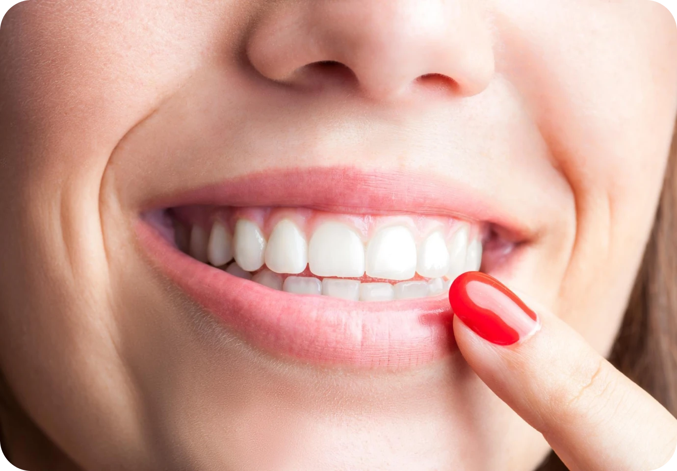 blanchiment dentaire alti dent Blanchiment dentaire Cabinet dentaire Alti Dent