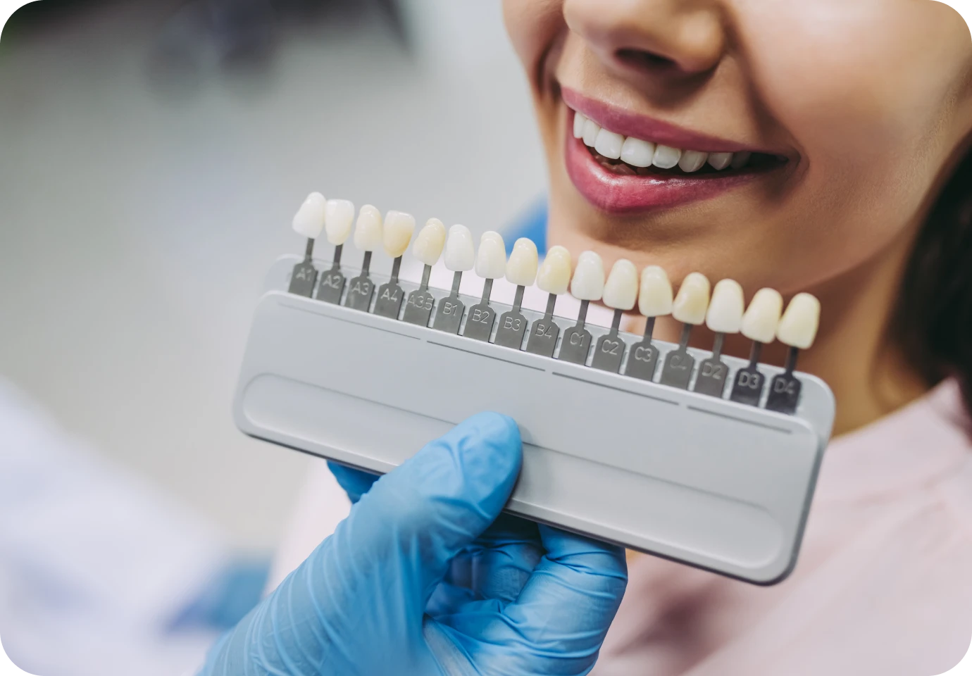 facettes dentaires alti dent Blanchiment dentaire Cabinet dentaire Alti Dent