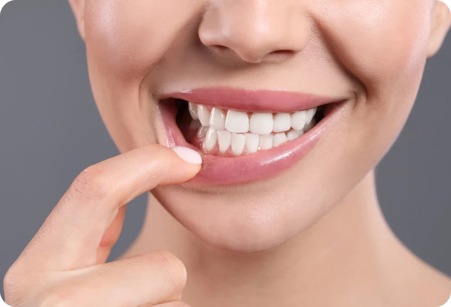 parodontologie clinique cabinet alti dent eybens Parodontologie clinique Cabinet dentaire Alti Dent