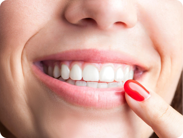 sourire dents blanches Blanchiment dentaire Cabinet dentaire Alti Dent