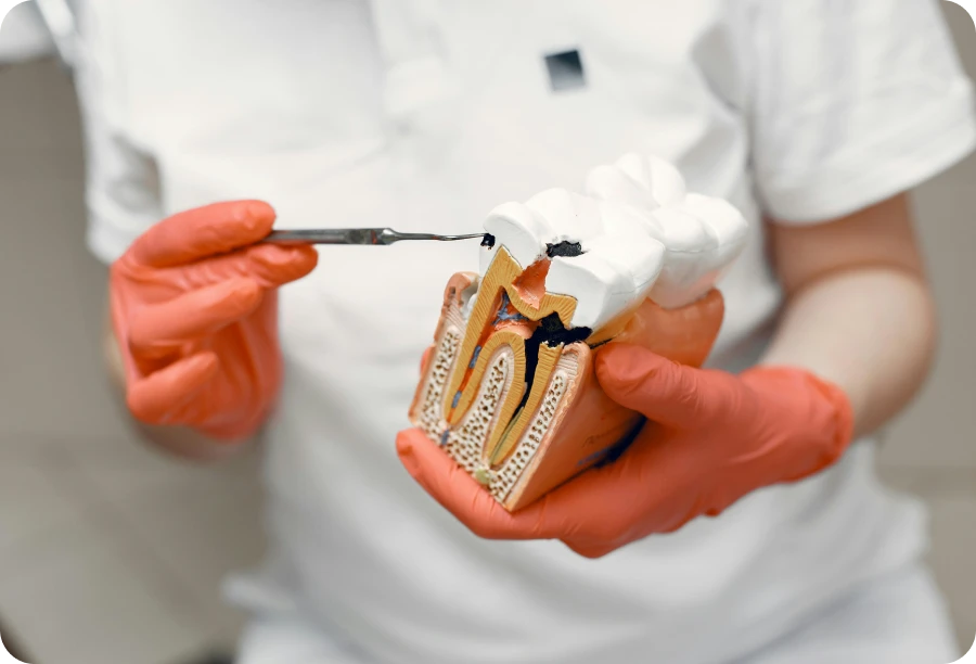 traitement caries cabinet dentaire alti dent Soins conservateurs Cabinet dentaire Alti Dent